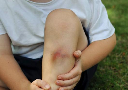 小孩子犯了错怎么处理(小孩子犯了错自己打自己)(图5)